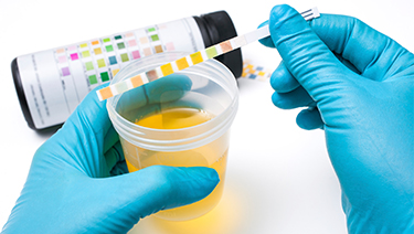 Urinary Tract Infections